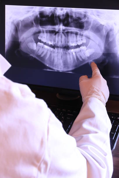 Best Holiday Emergency Dentist in Culver, OR